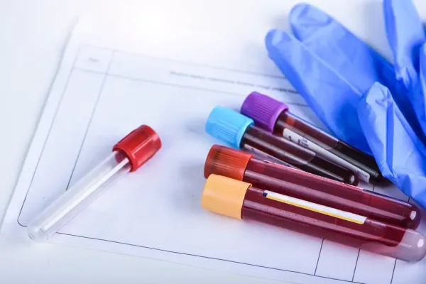 PNH Şüphesi Olduğunda Hangi Testler Yapılmalıdır?